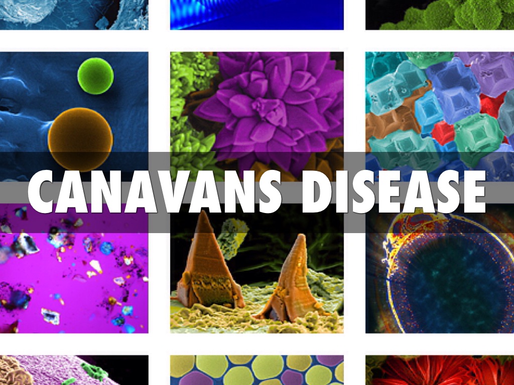 Canavans Disease 