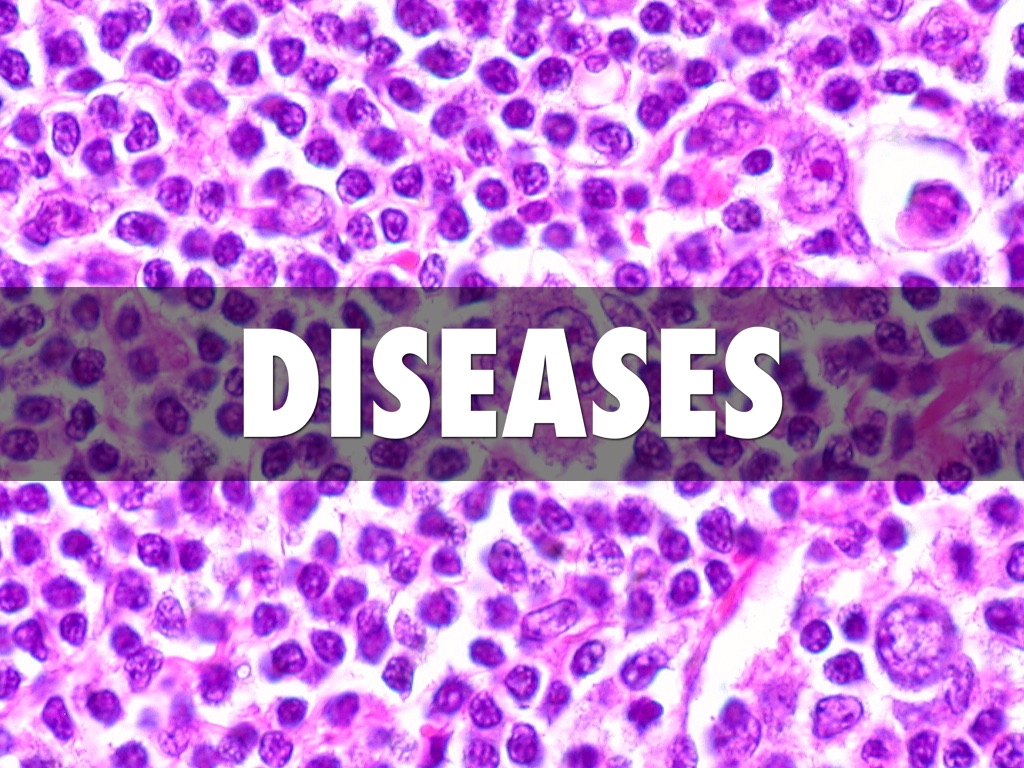Diseases