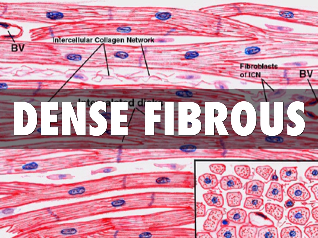 Copy of Tissue by Cameron Flippo