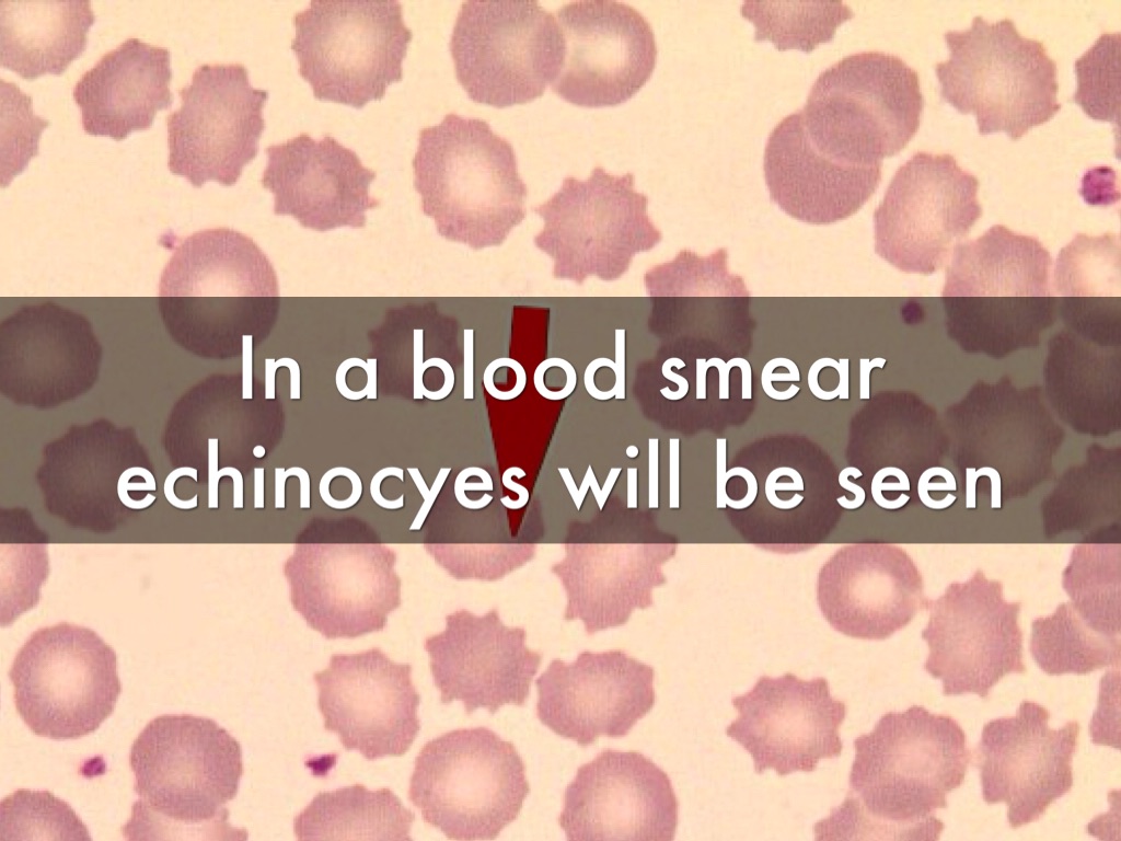 Rattlesnake by Alyssa Beyer