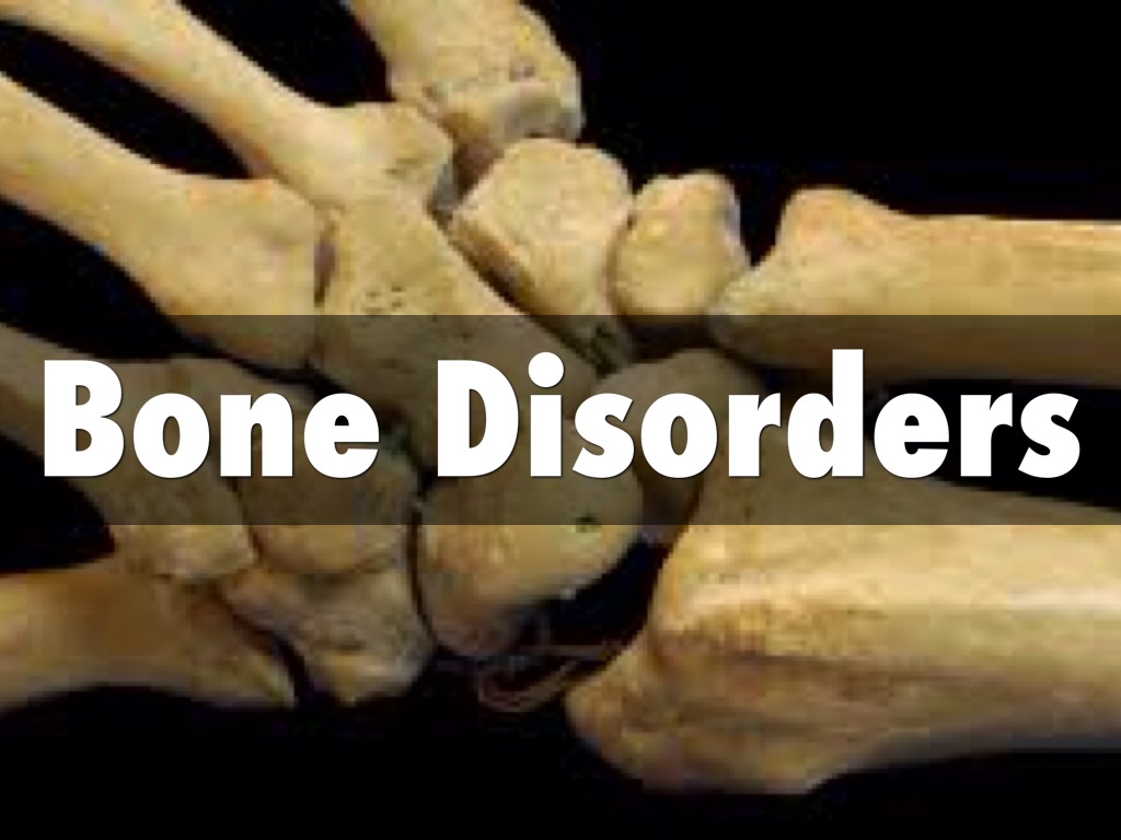 Classification Of Bone Disorders