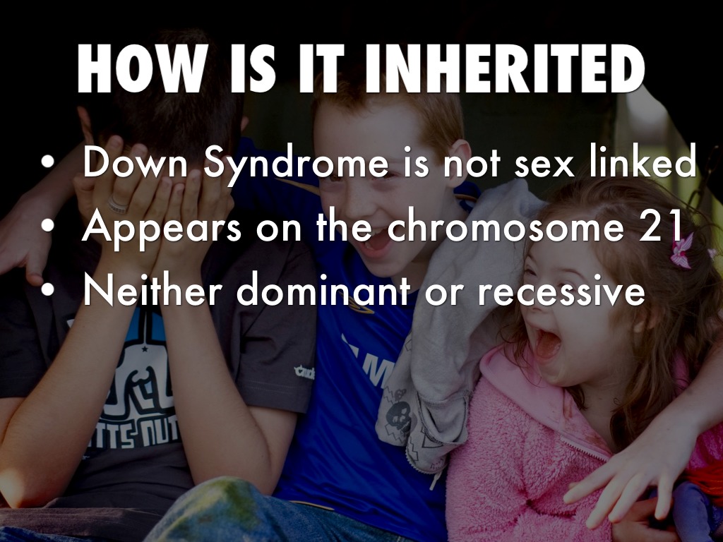 Down Syndrome by Will Rhodes