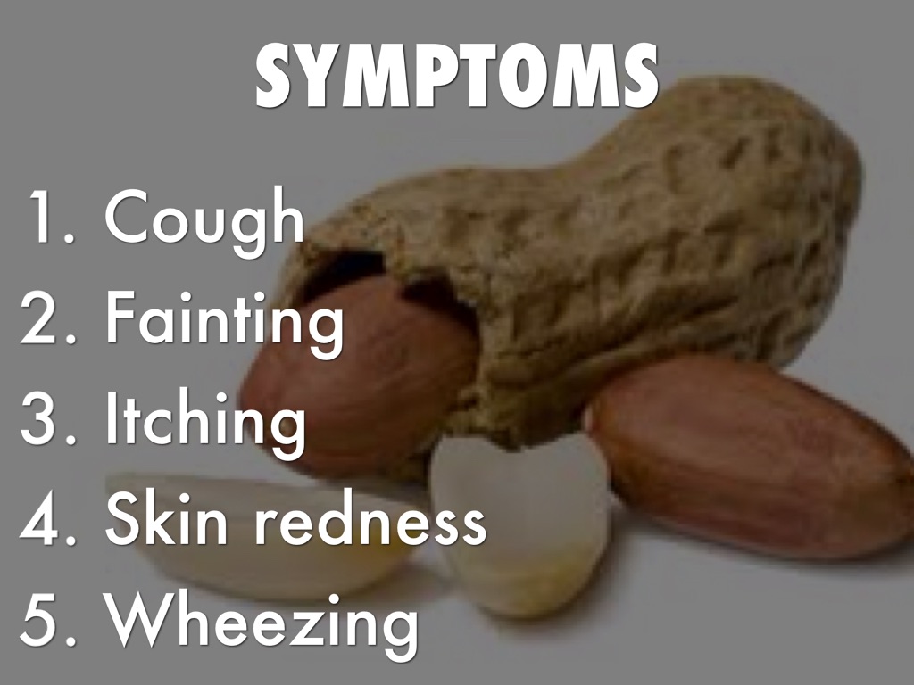 Food Allergies by Scott Christopher