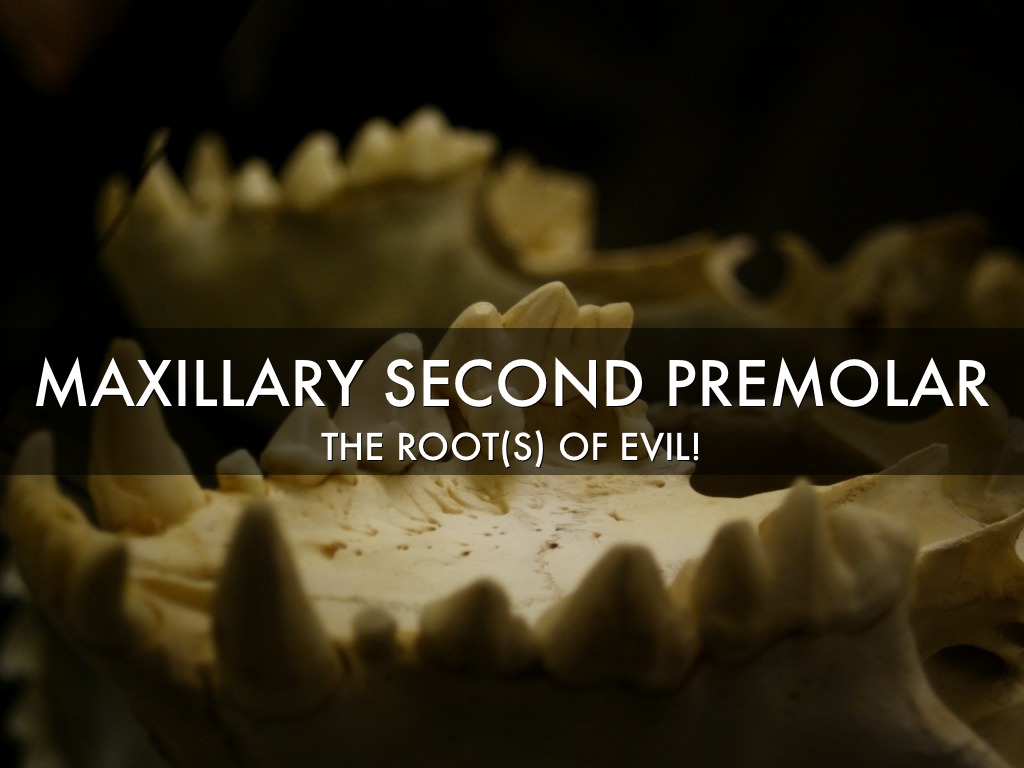 Maxillary Second Premolar - The Root(s) Of All Evil!