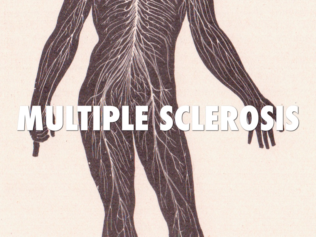 Multiple Sclerosis 