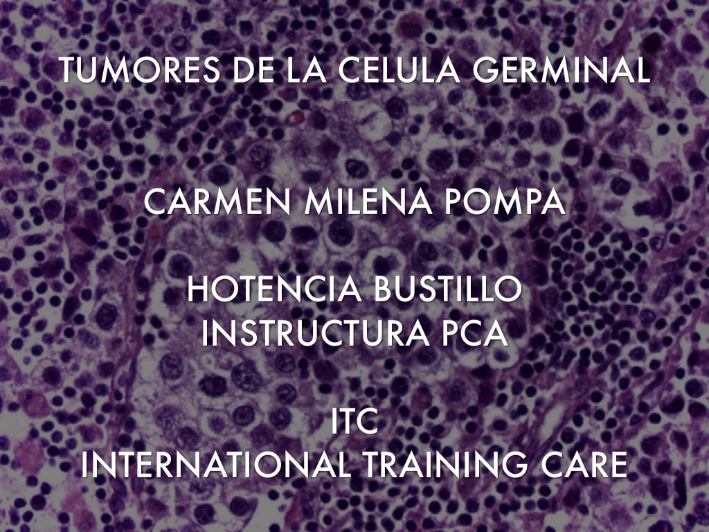 TUMORES DE LA CELULA GERMINAL