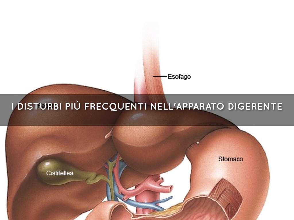 Le Malattie Più Frequenti Dello Stomaco