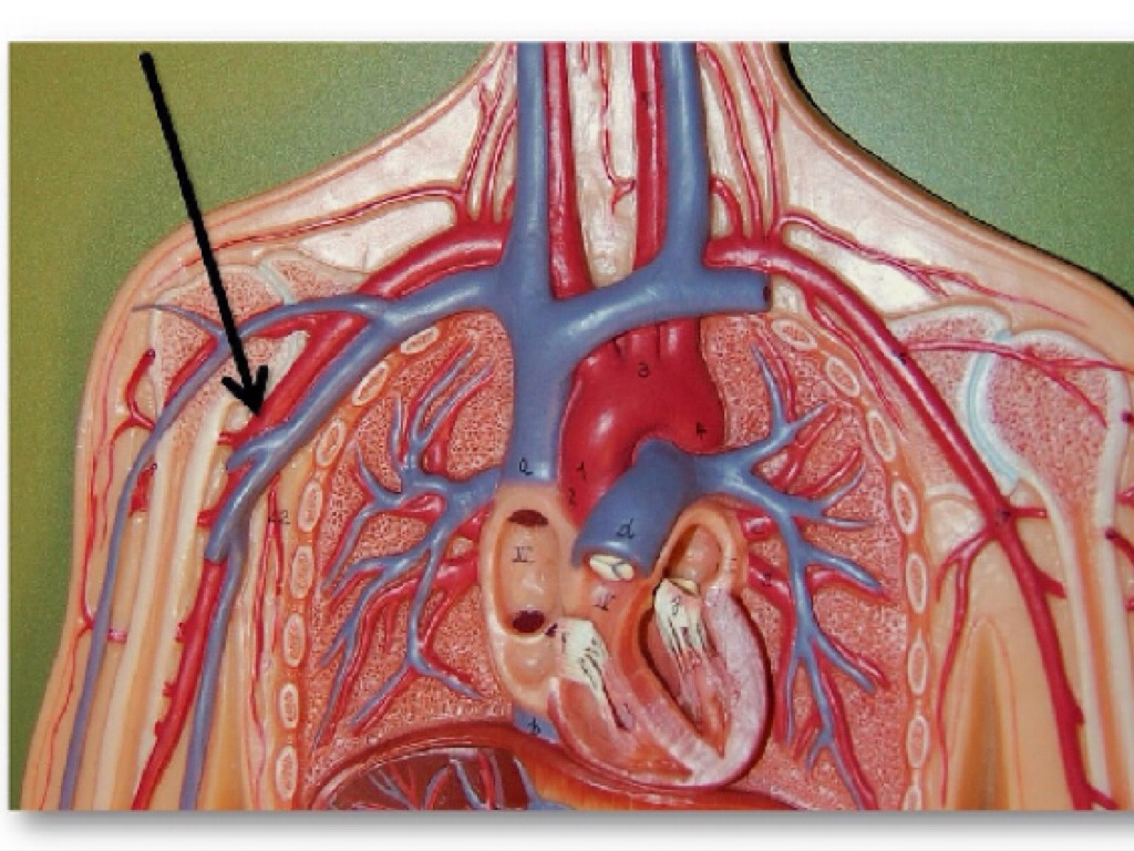 Arteries by Alex Hodjat