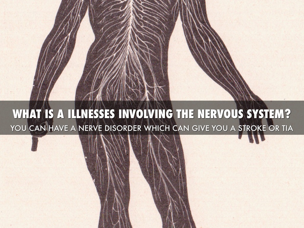 Nervous System by Jacob Abramsom