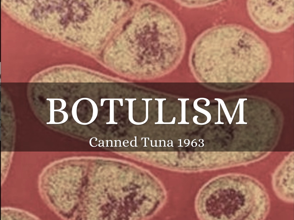 Botulism by a1.princessliaa