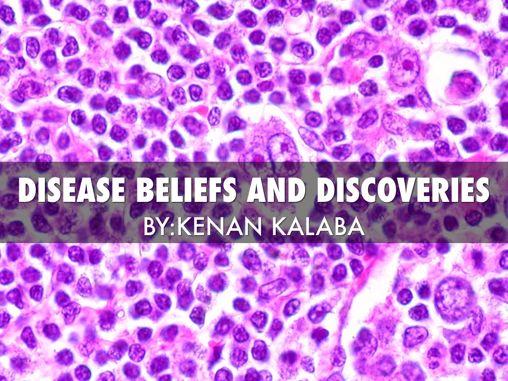 Disease Beliefs And Discoveries