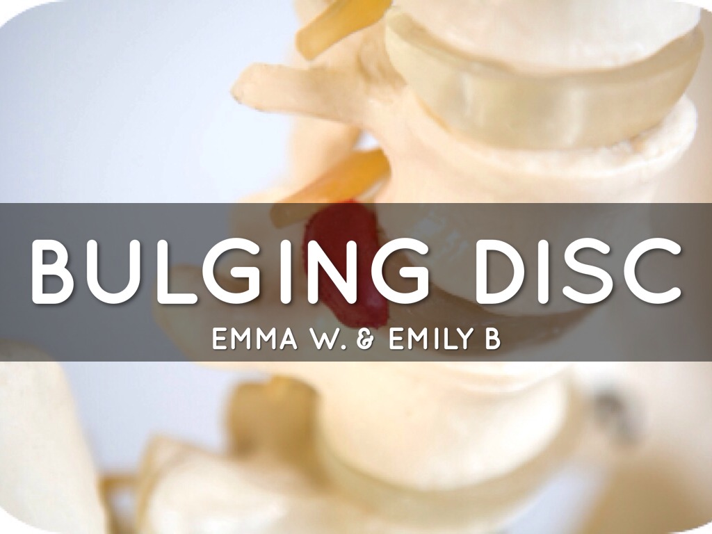 Case Study: Bulging Disks by emilybird7
