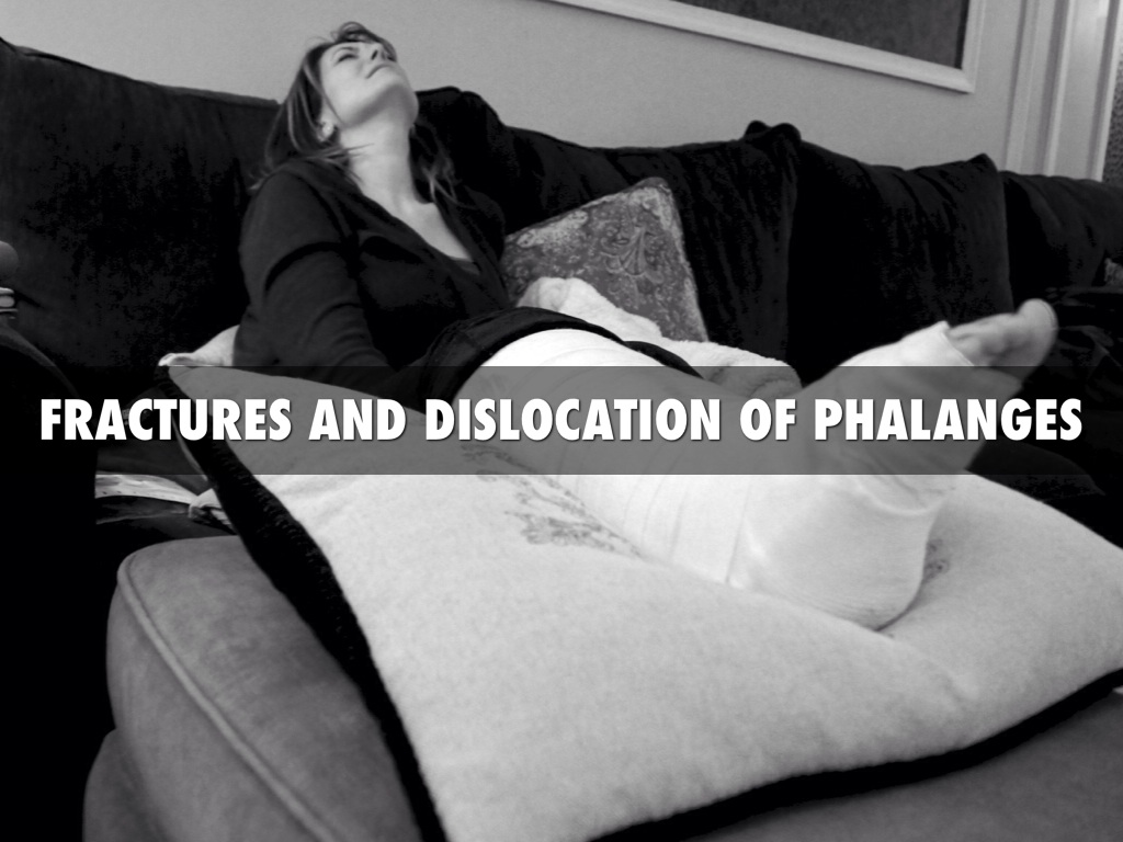 Fractures And Dislocations Of Phalanges