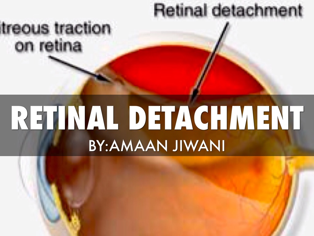 7_JiwaniAmaan_LightEyeDisorderProduct