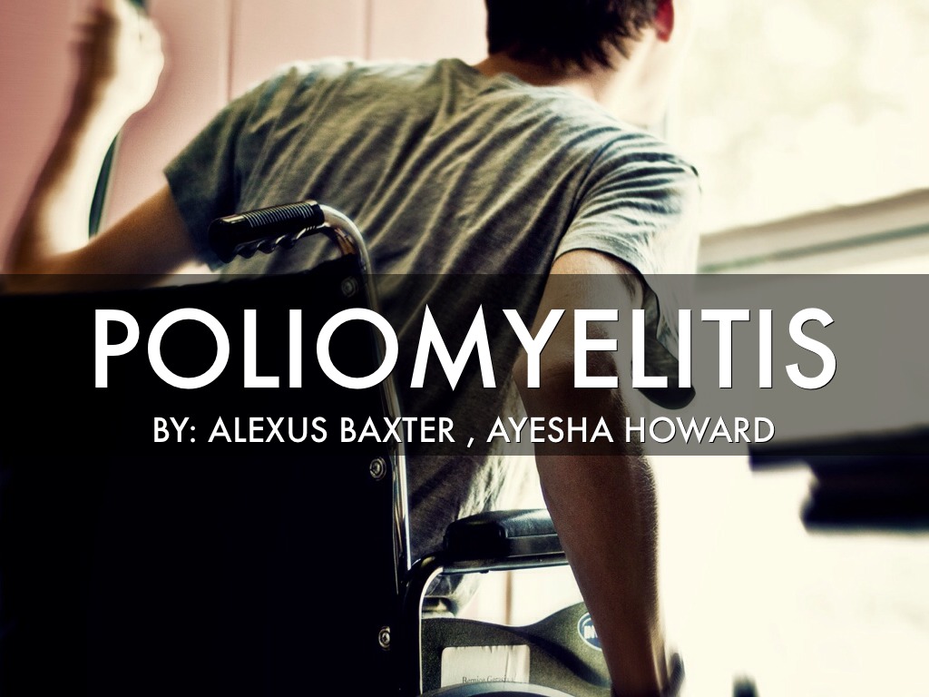 Poliomyelitis 