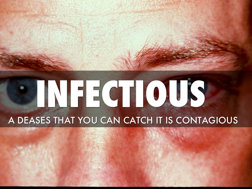 Infectious 