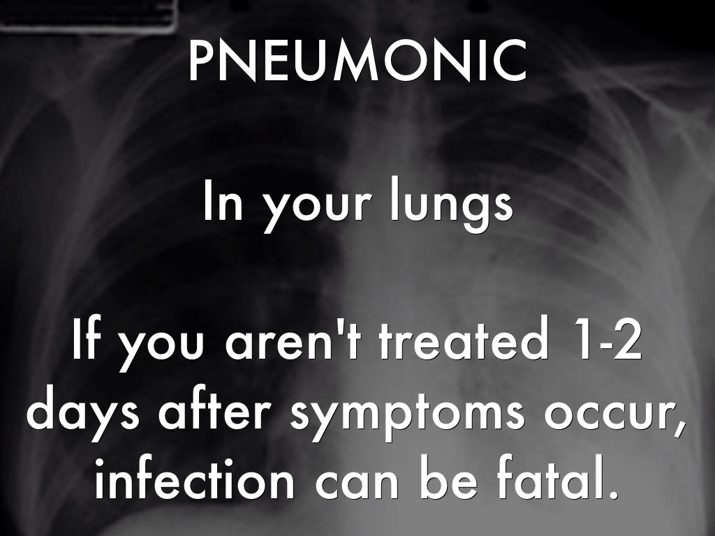 Black Plague by Amber Schmelzer