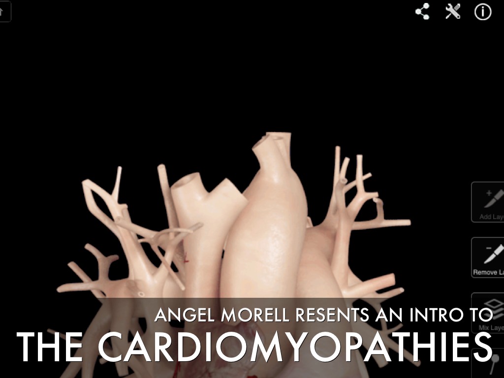 Intro To Cardiomyopathies