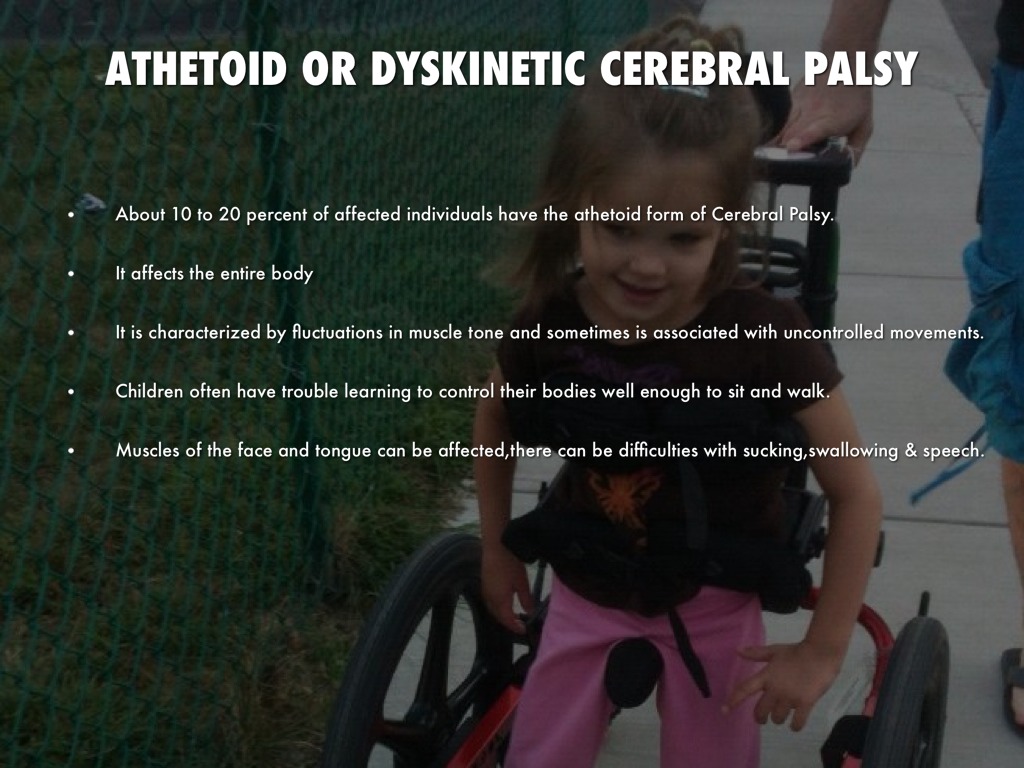 Cerebral Palsy
