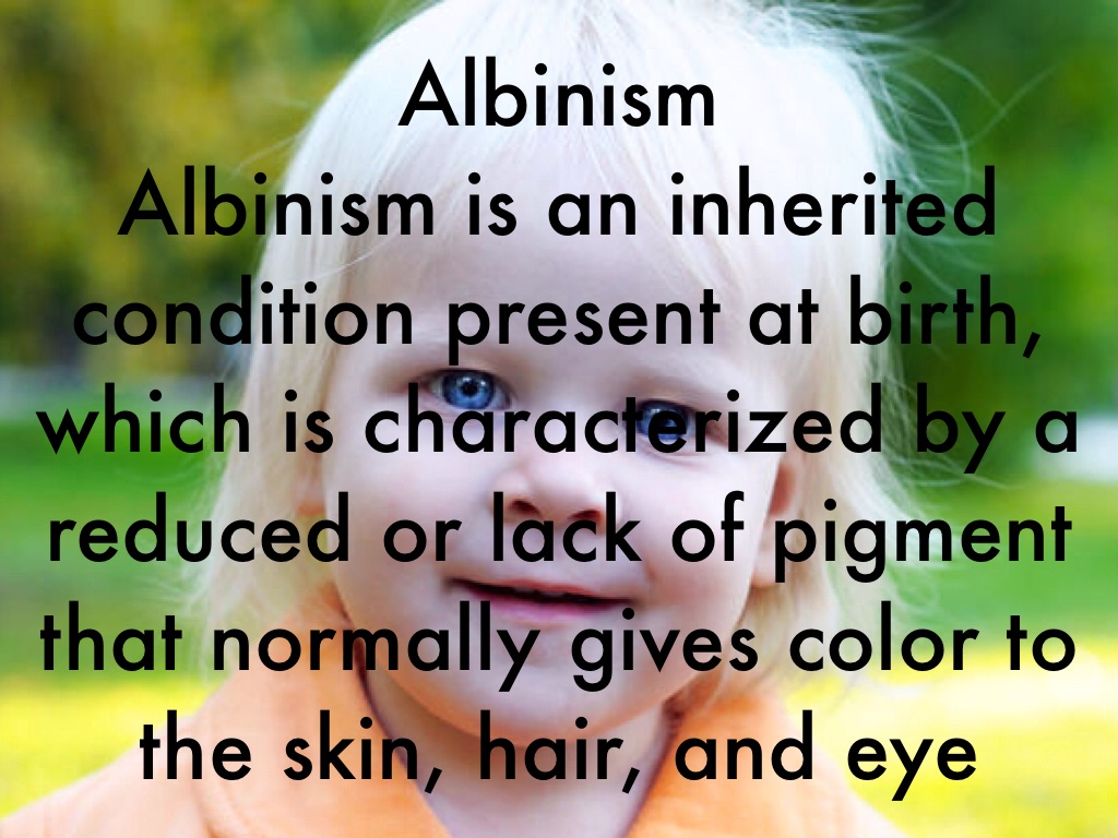 Albinism