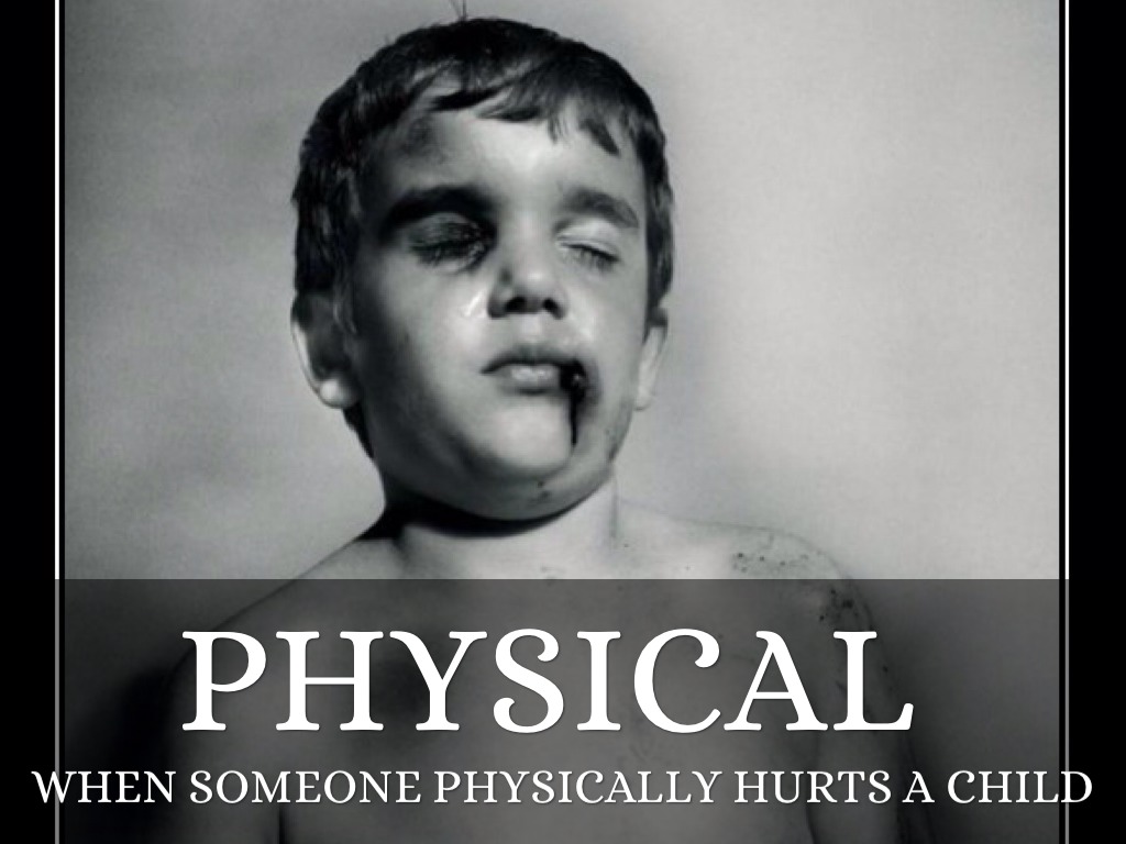 Fever as related to Child abuse - physical - Pictures