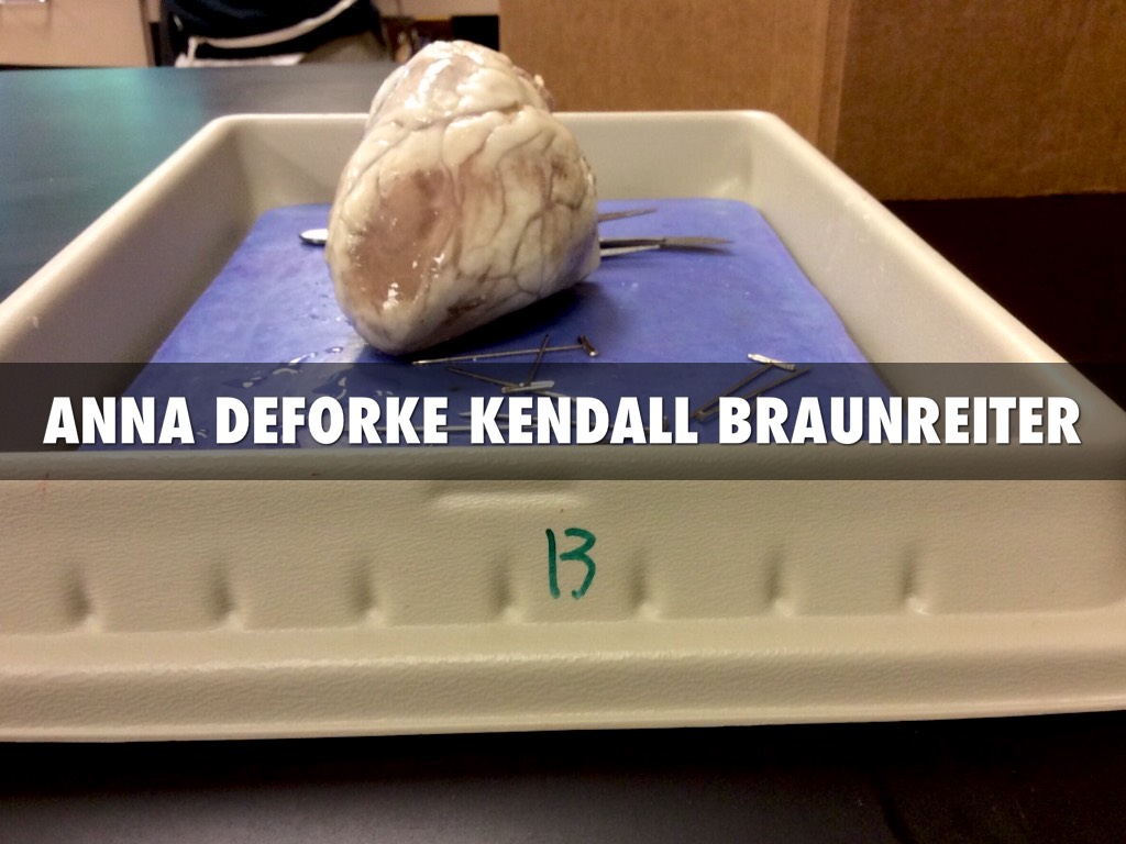 Sheep Heart Dissection