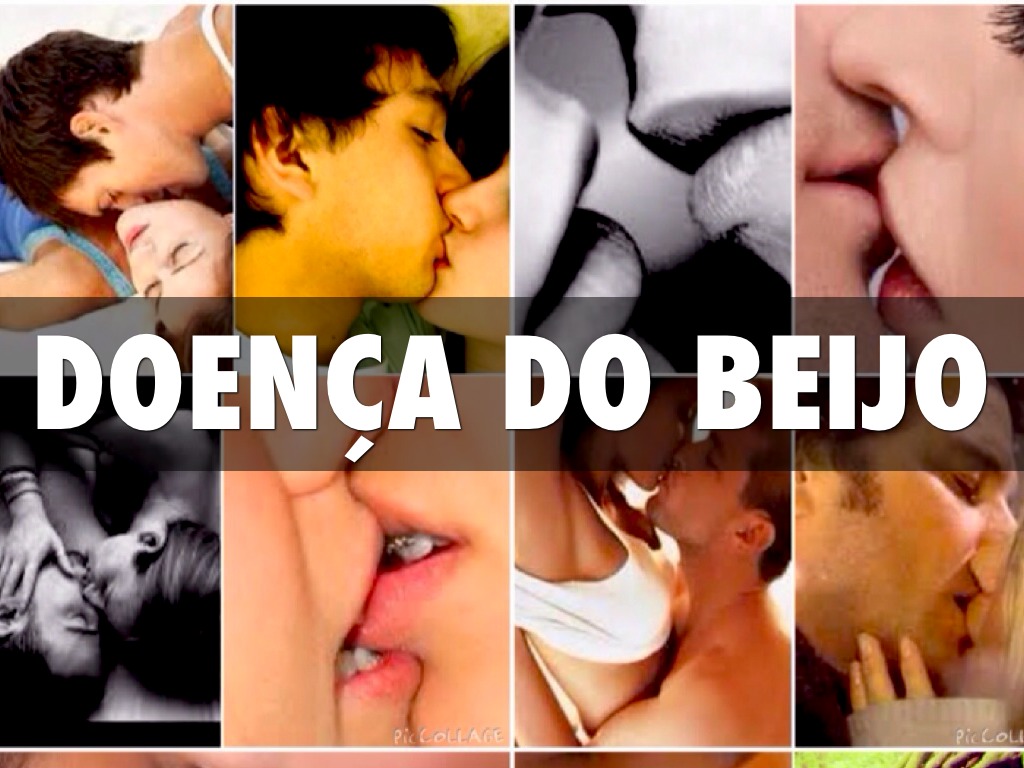 Doença Do Beijo