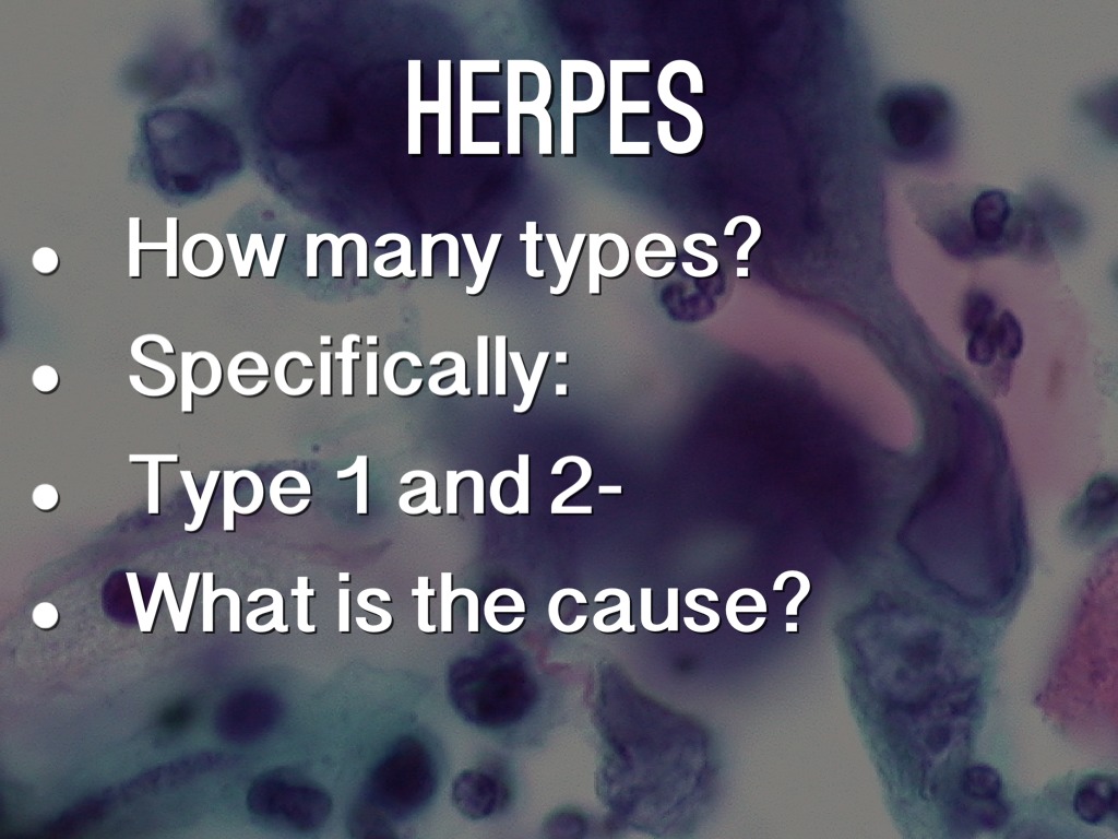 The Herpes Virus