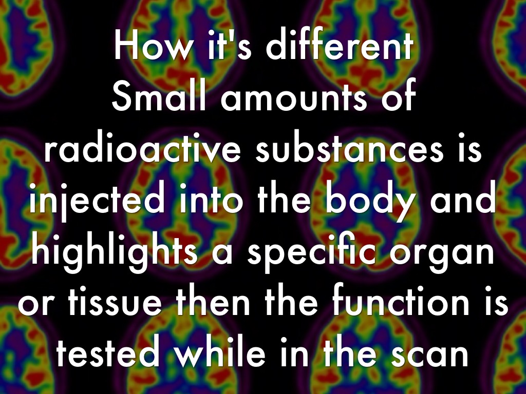 Nuclear Medicine by Casey Spencer