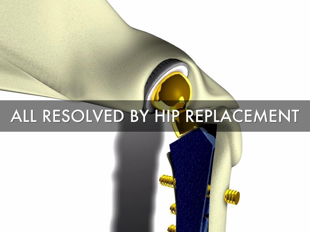 Veterinary Hip Replacement by Andy Torrington