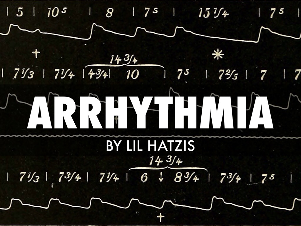 Arrhythmia 