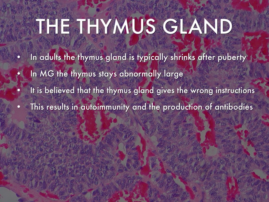 Myasthenia Gravis by keele.halbert Myasthenia Gravis by keele.halbert