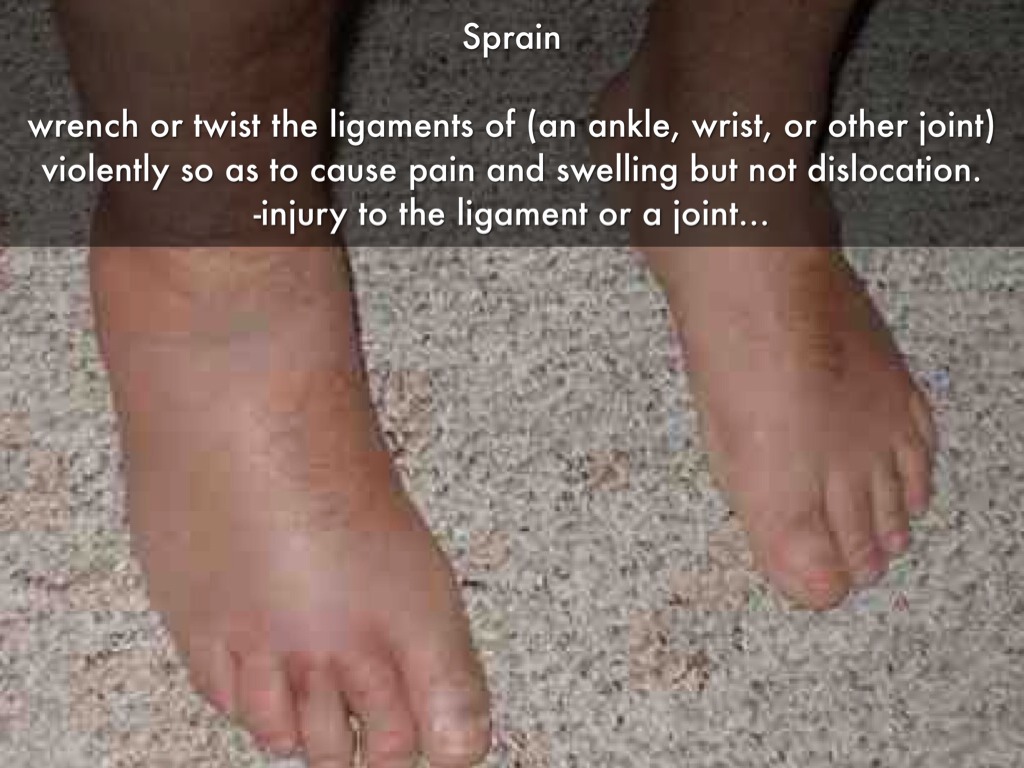 Injury S by Kaitlyn Perry