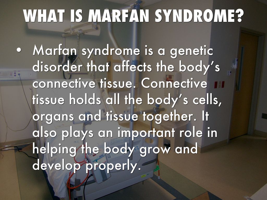 Marfan Syndrome