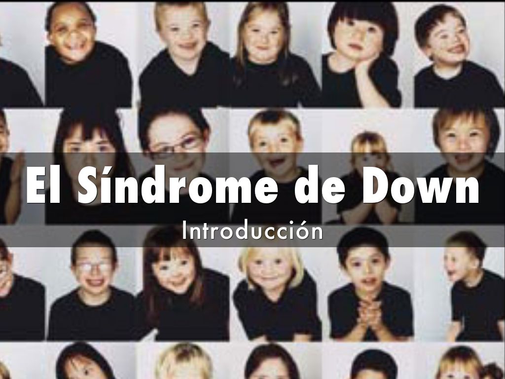 Síndrome de Down