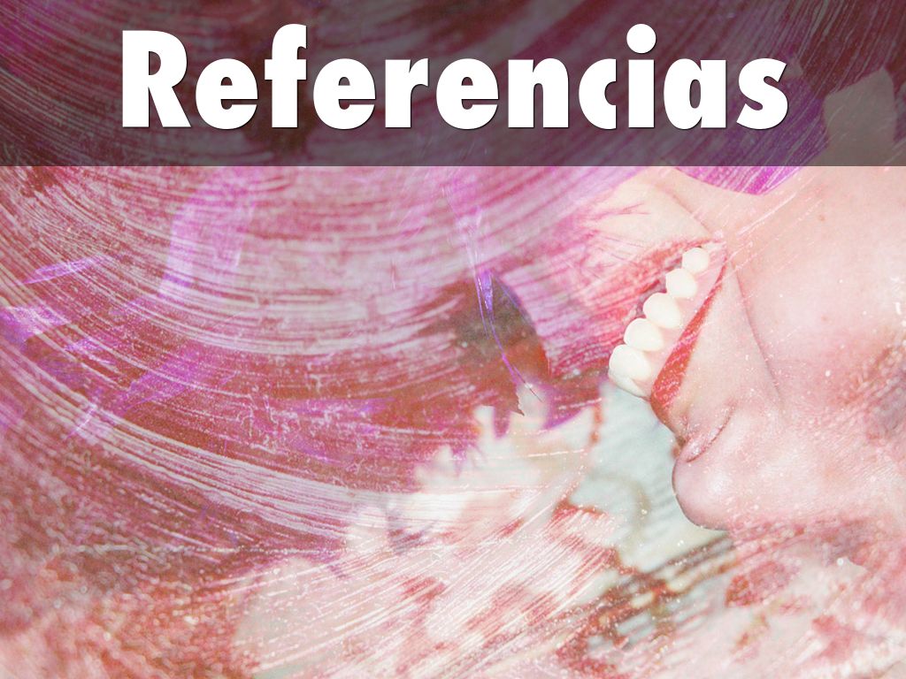 Referencias