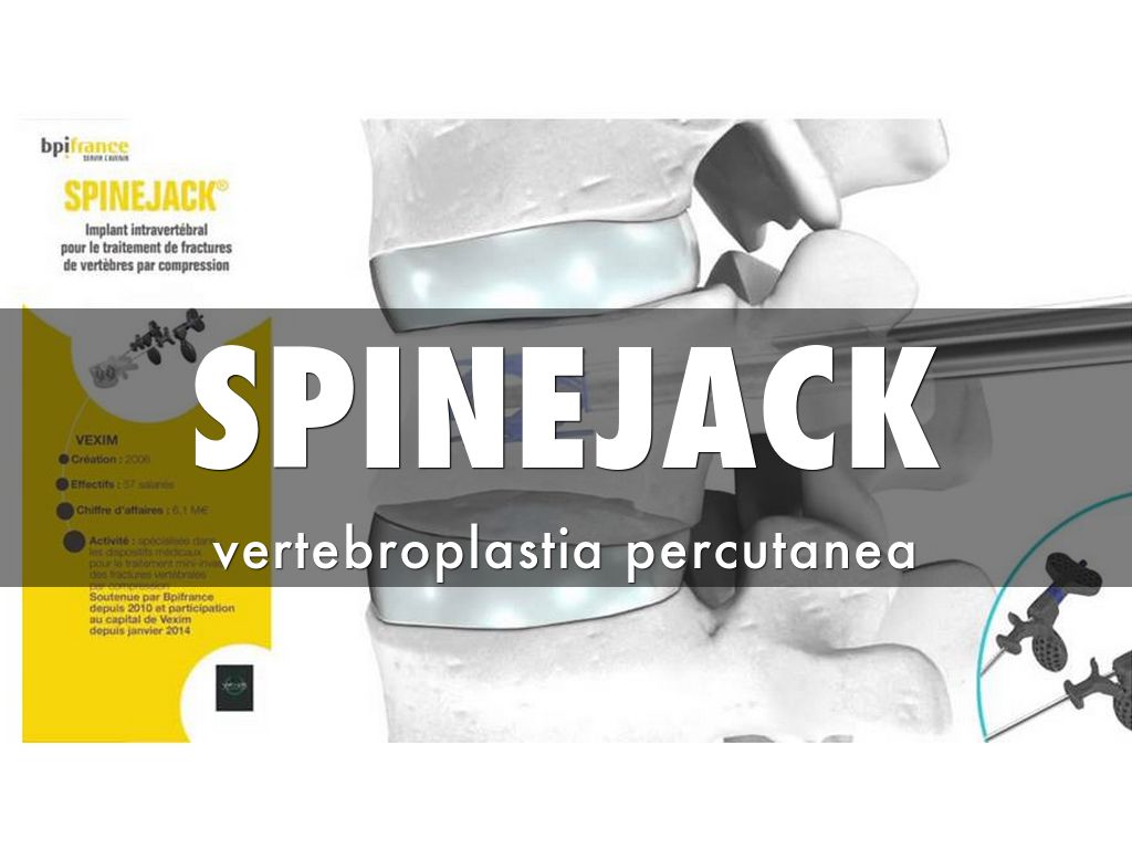 Copy of SPINEJACK by Lau Romero