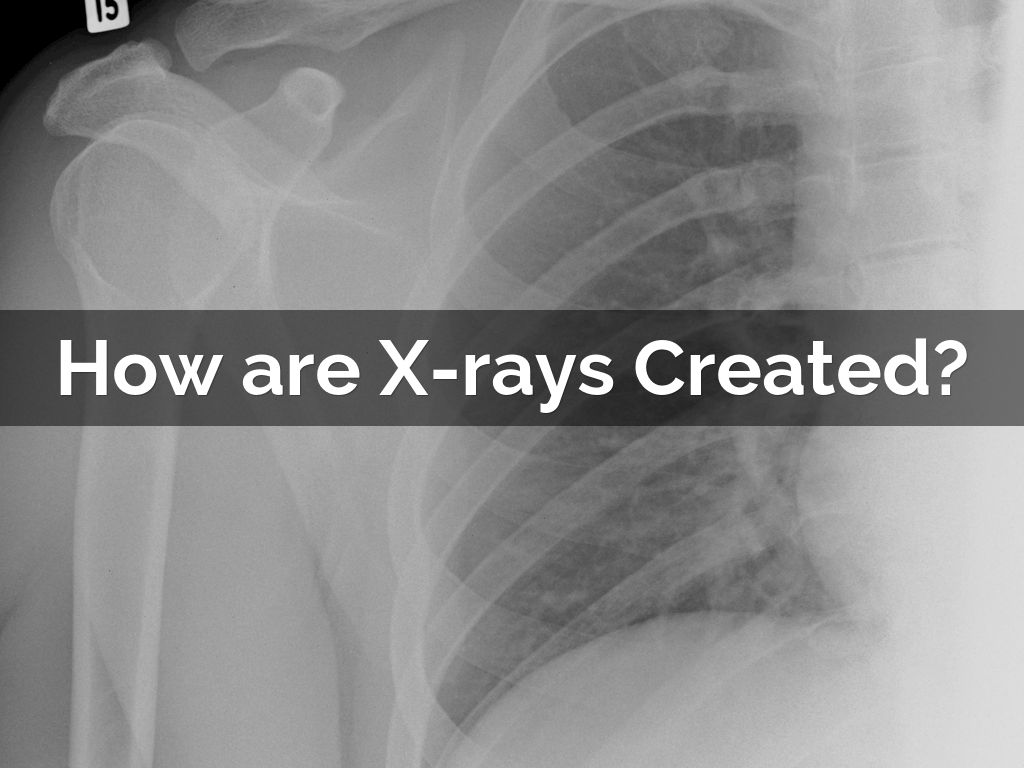 How are Xrays Created? by mness