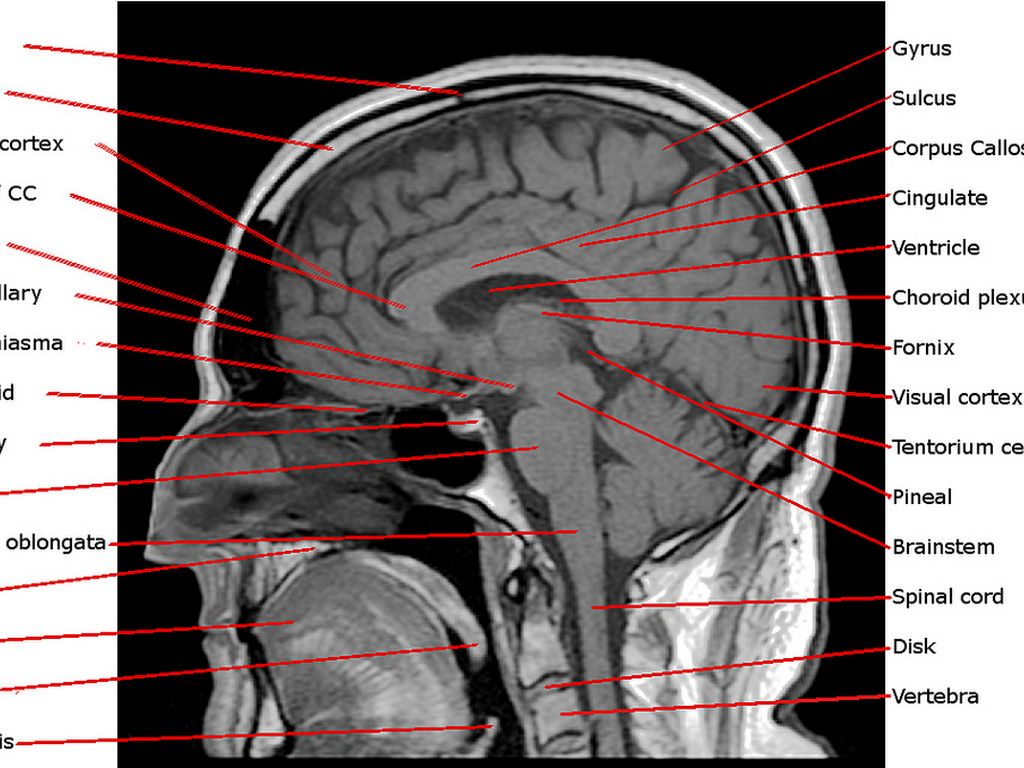 Sheep Brain Dissection Vita AP Psych