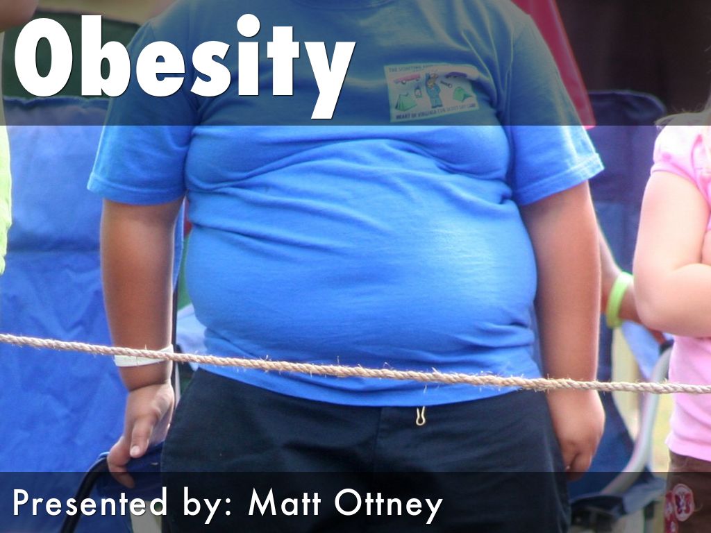 Obesity