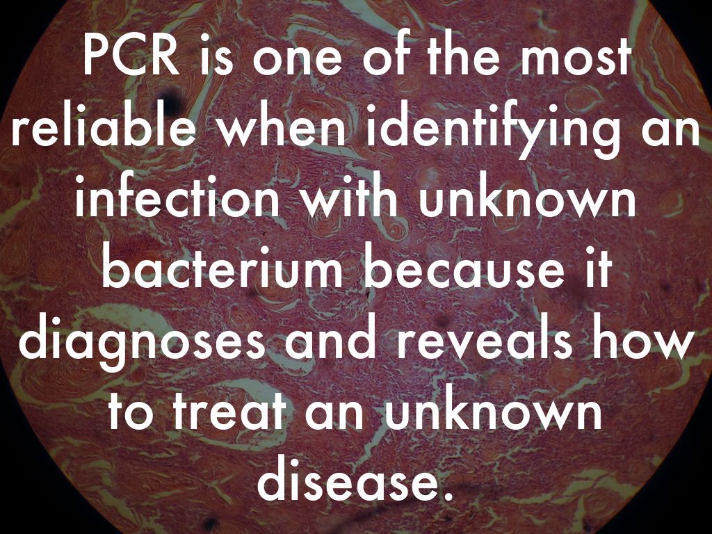 Identifying DNA by Alexis Ervine