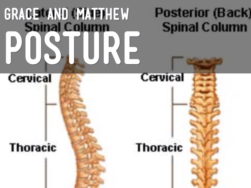 Posture