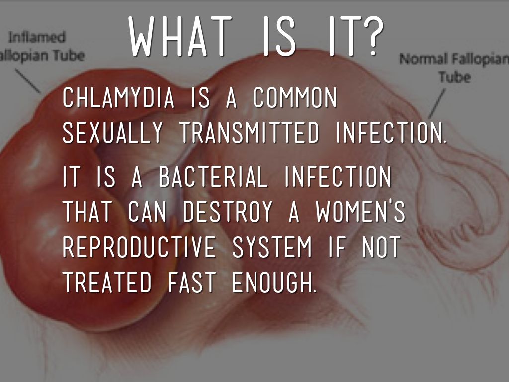 Chlamydia Health Project by Katie Bradford