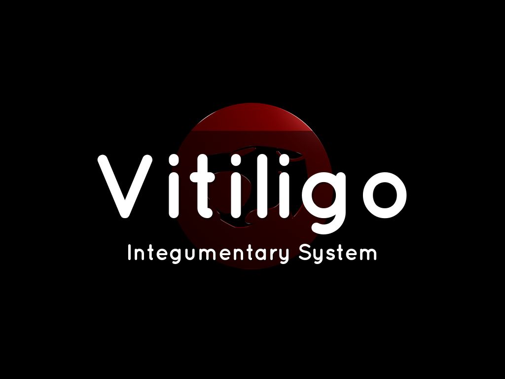 Vitiligo