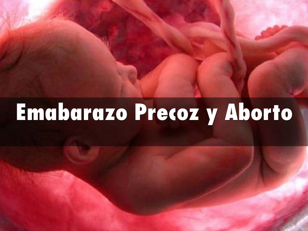 Precoz aborto que es