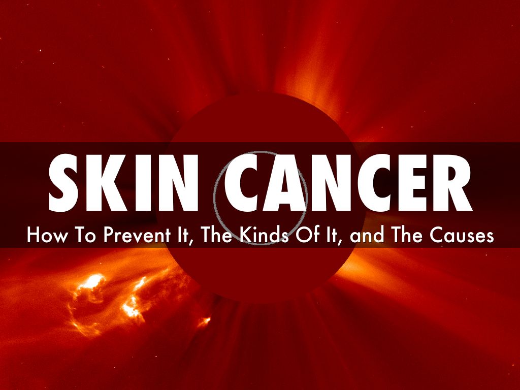 skin cancer