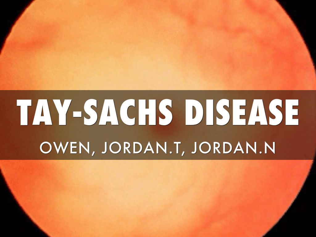 Tay-Sachs Disease
