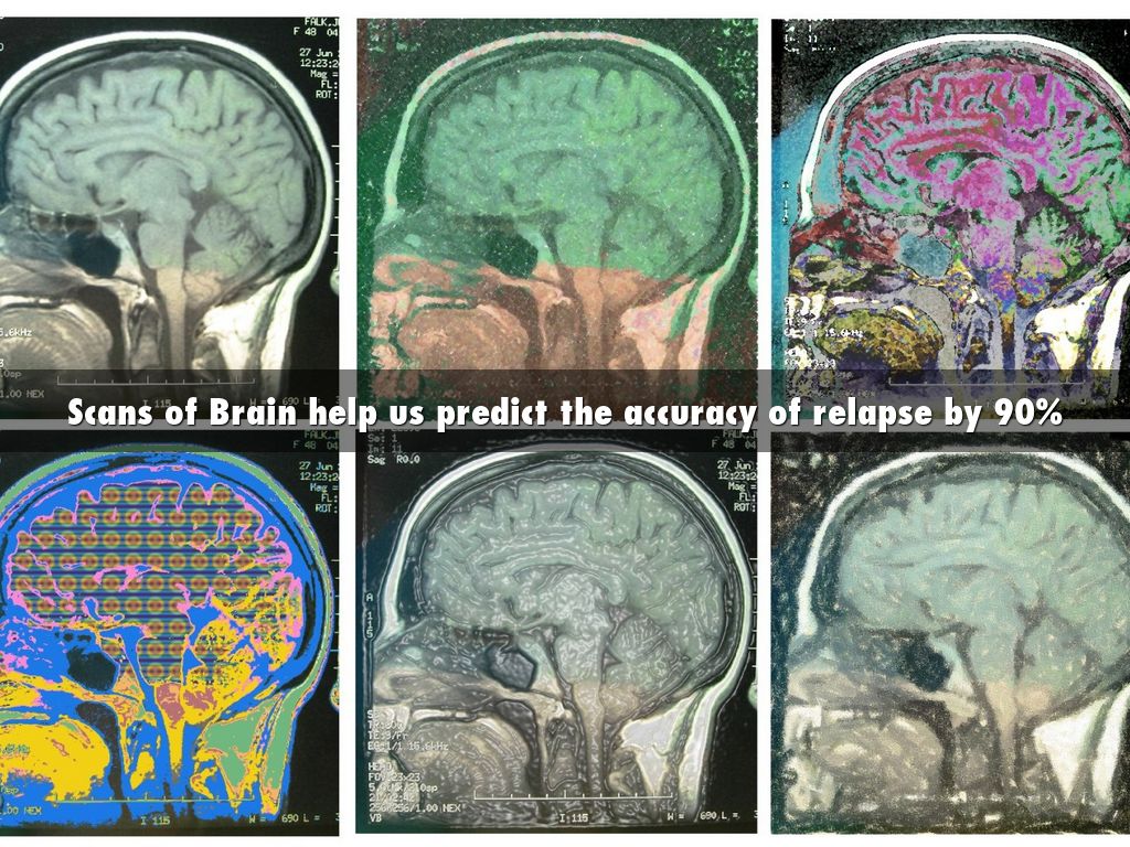 Brain scans. скан мрт мозга. нейроинфекции головного мозга. снимки мрт глаза. Brain scans.