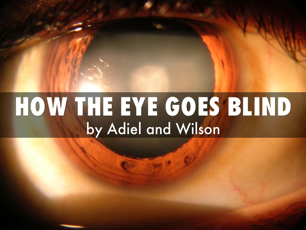 How the eye goes blind by supwww