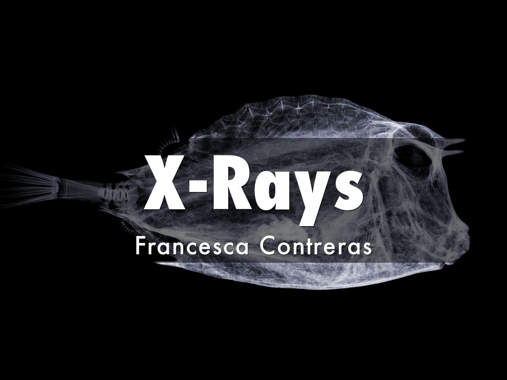 Copy of X-Rays